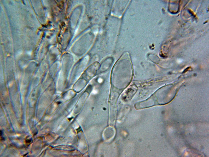Butyriboletus regius 10 - Cistidios 2